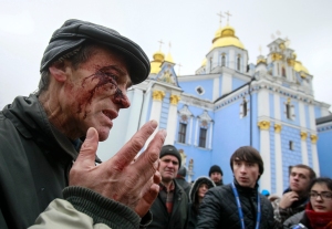 A man, injured during a scuffle at a demonstration in support of EU integration, speaks with media during a rally in Kiev